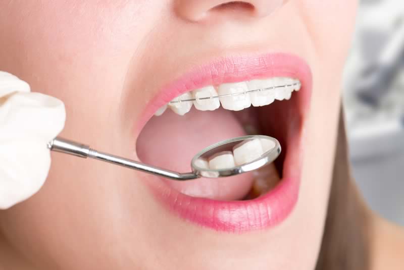Orthodontics