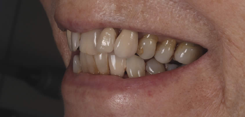 bridge after