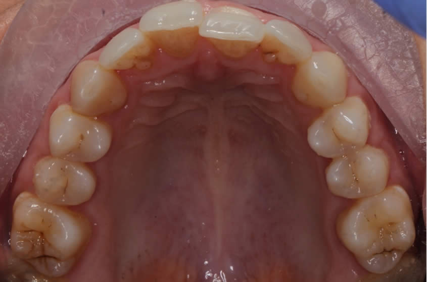 Orthodontics