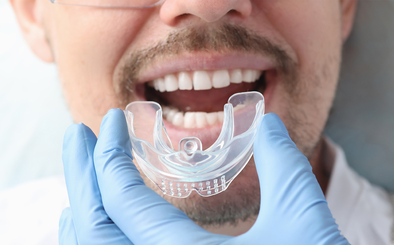Oral Hygiene Advice